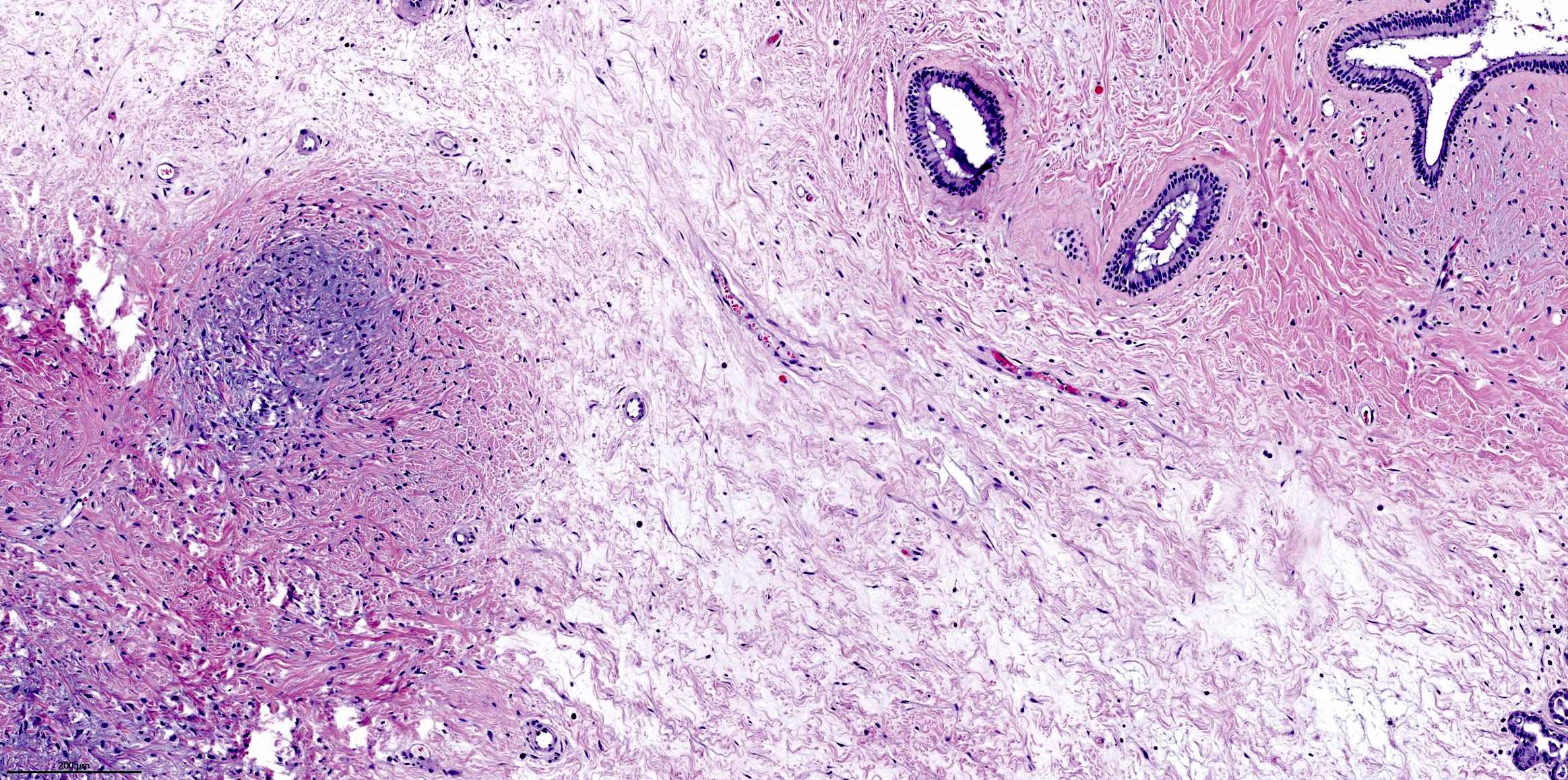 Myxoid mesenchyme and gland