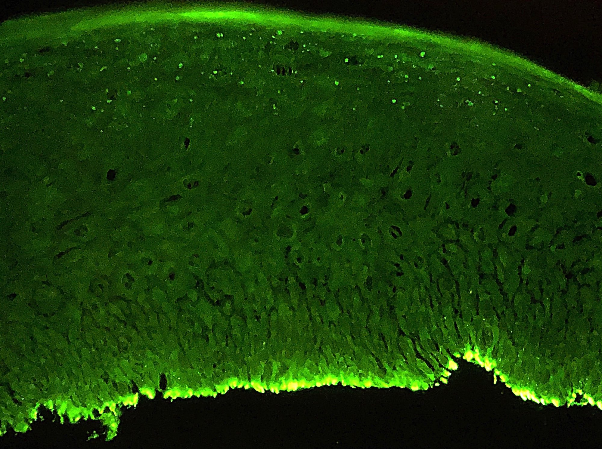 Bullous Pemphigoid Immunofluorescence
