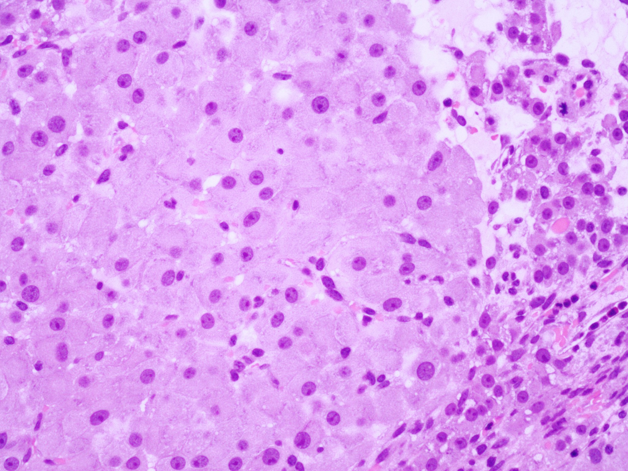 Granulosa and theca cells