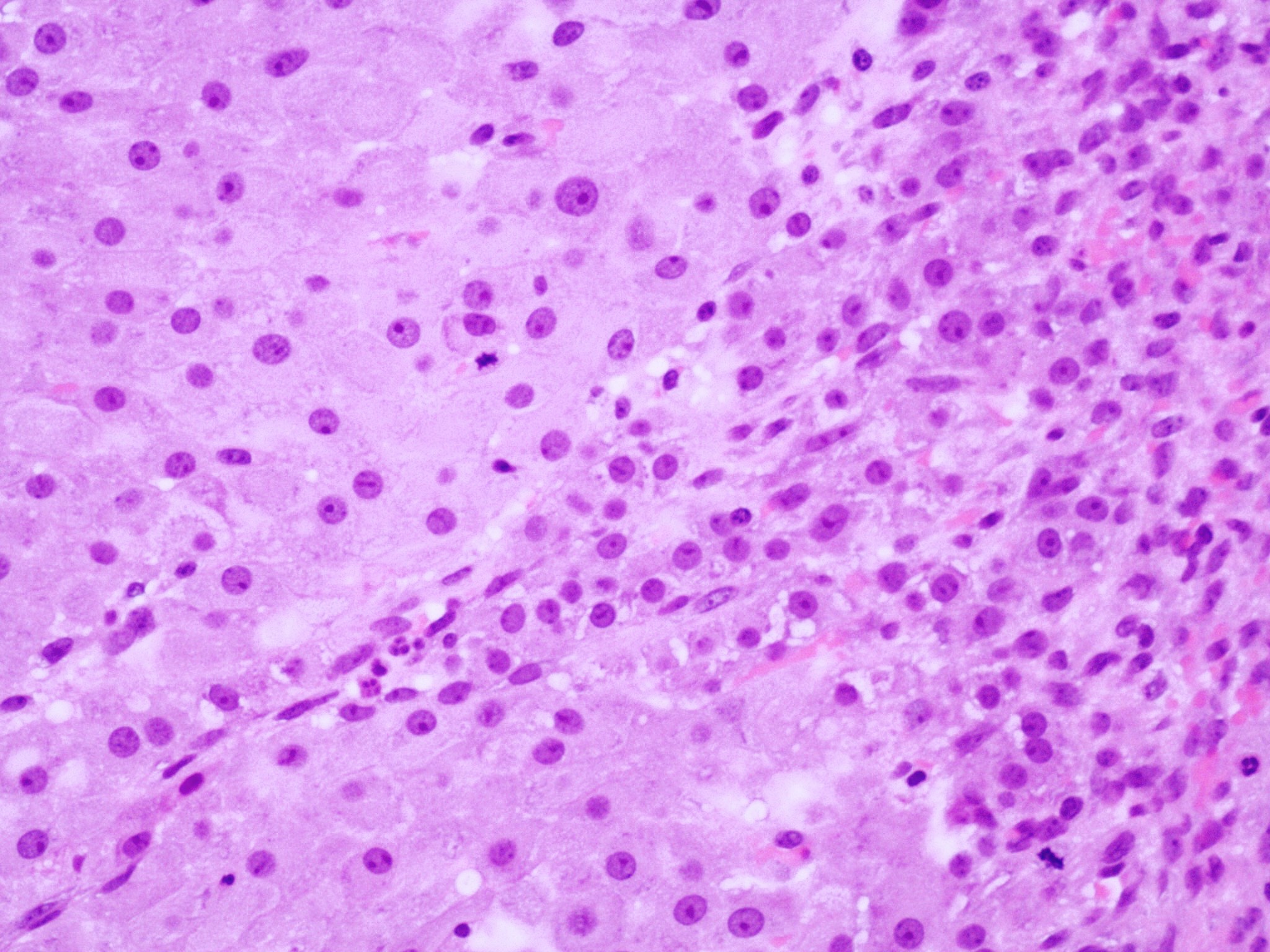 Granulosa and theca cells