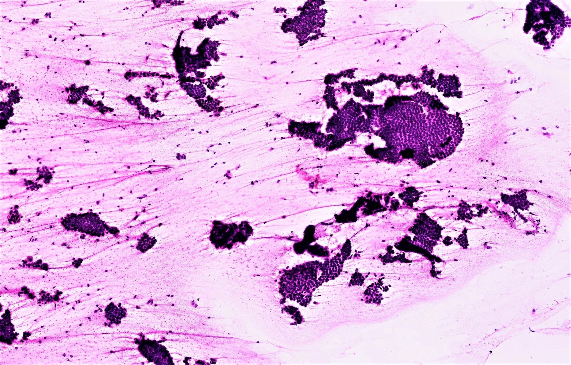 Clusters of cells with irregular contours