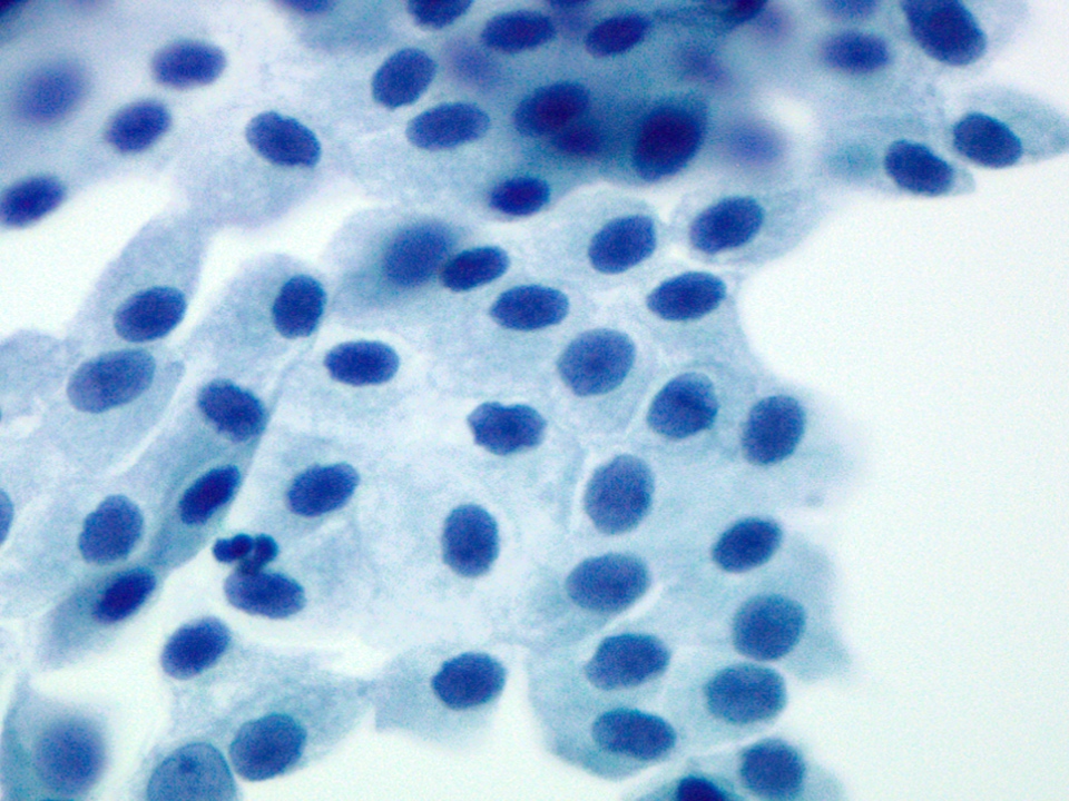 Mesothelial cells in sheets