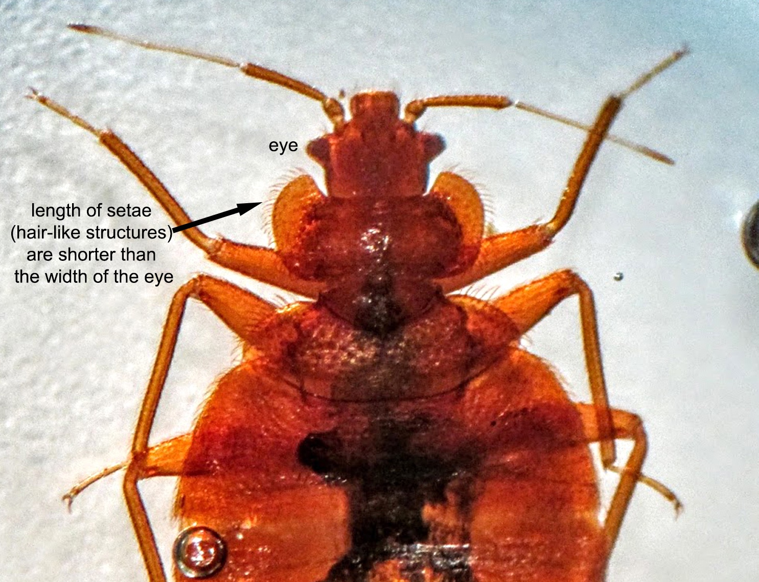Pathology Outlines Cimex Lectularius Bed Bug