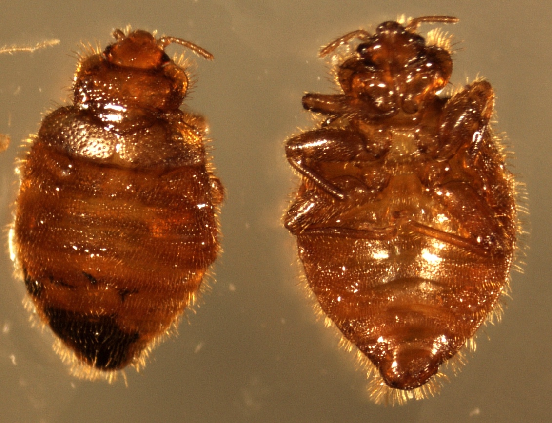 Pathology Outlines - Cimex lectularius (bed bug)