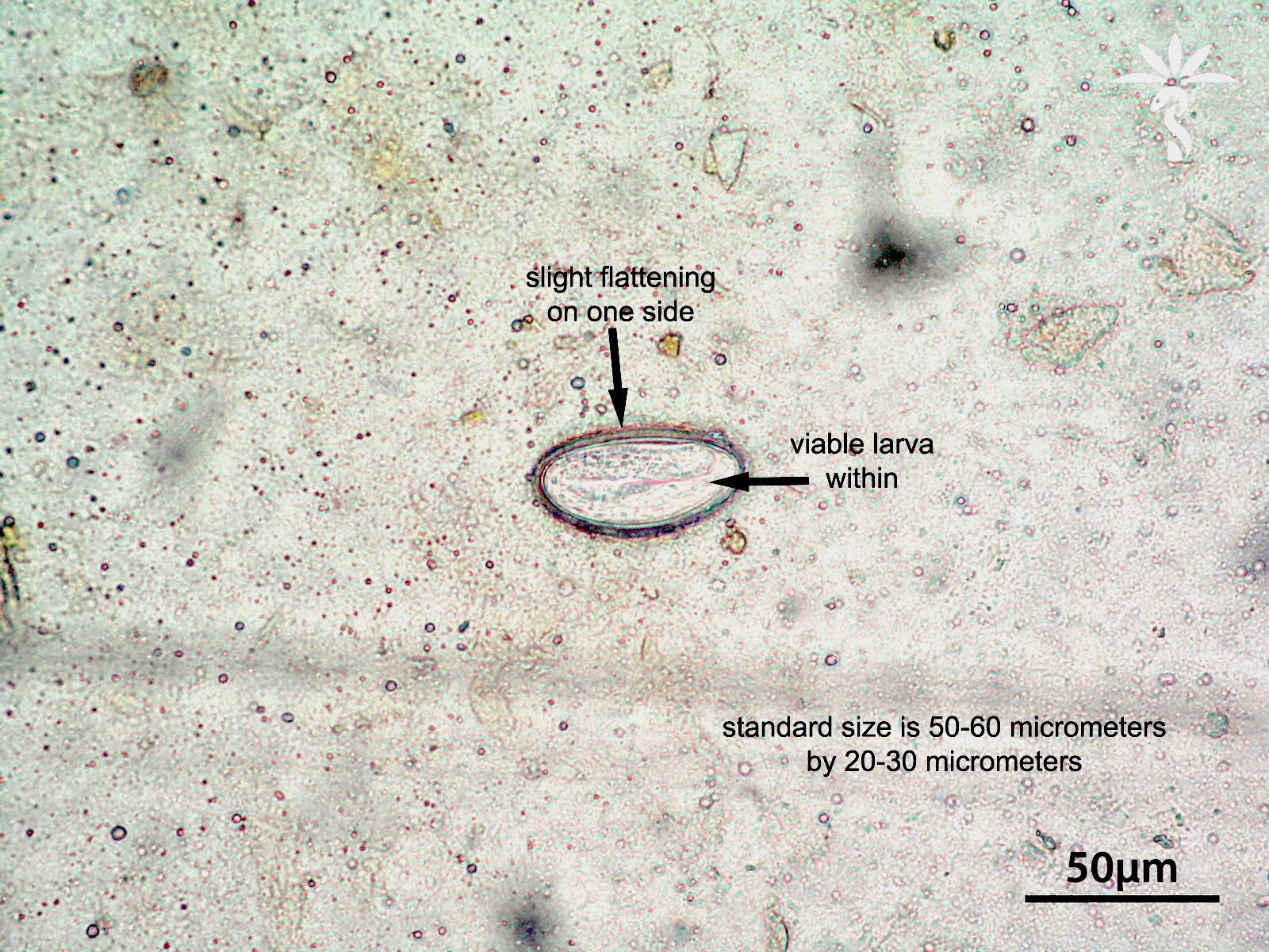 Pinworms este situat în, Enterobius vermicularis pathology - Enterobius vermicularis pathology