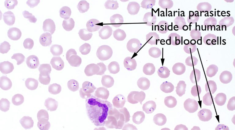 Az ookineta malária plazmodium képes)