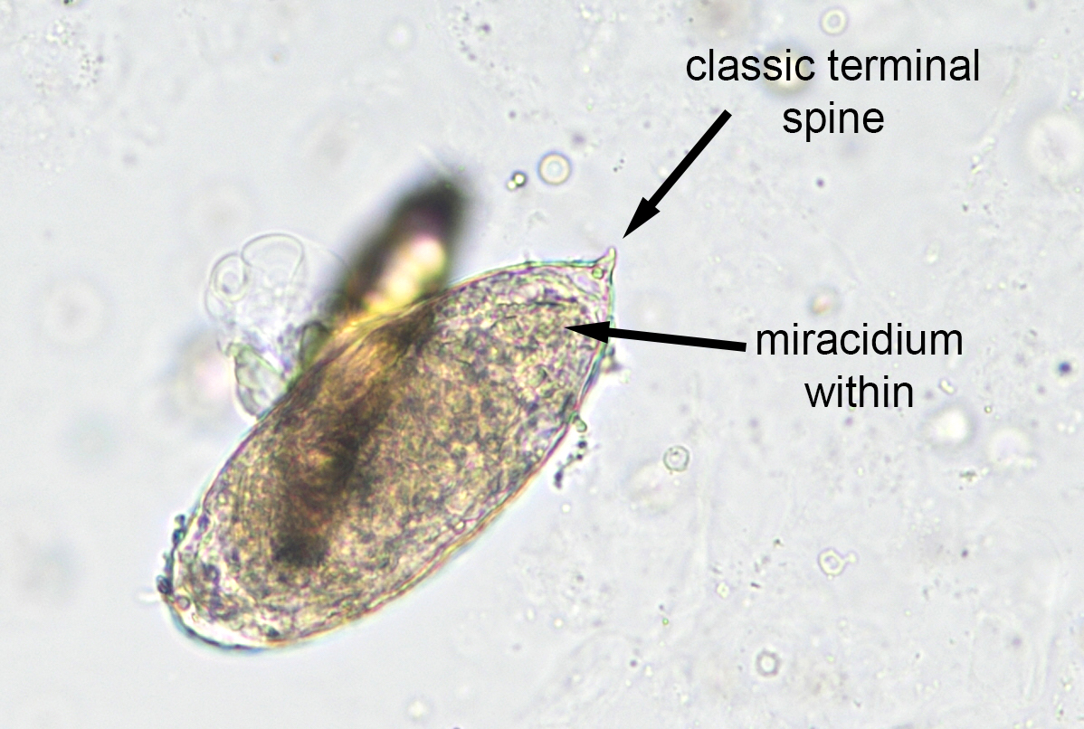schistosoma japonicum)