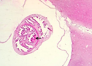 Cysticercus
