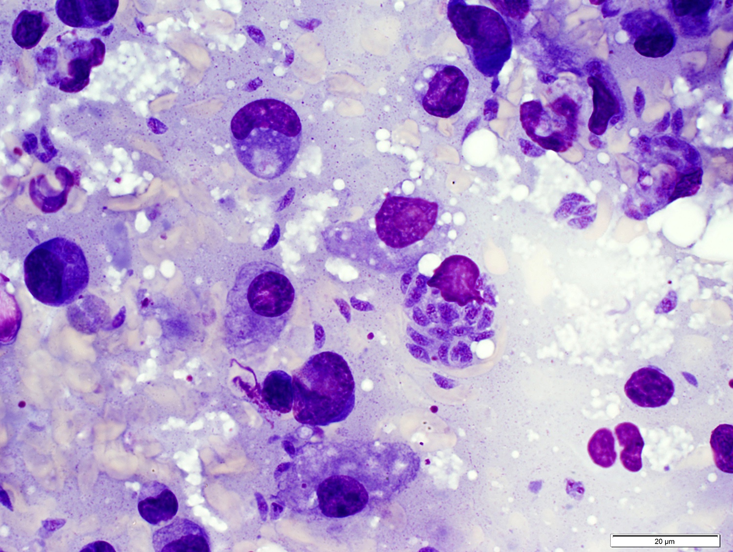 Tachyzoites of <i>Toxoplasma gondii</i>