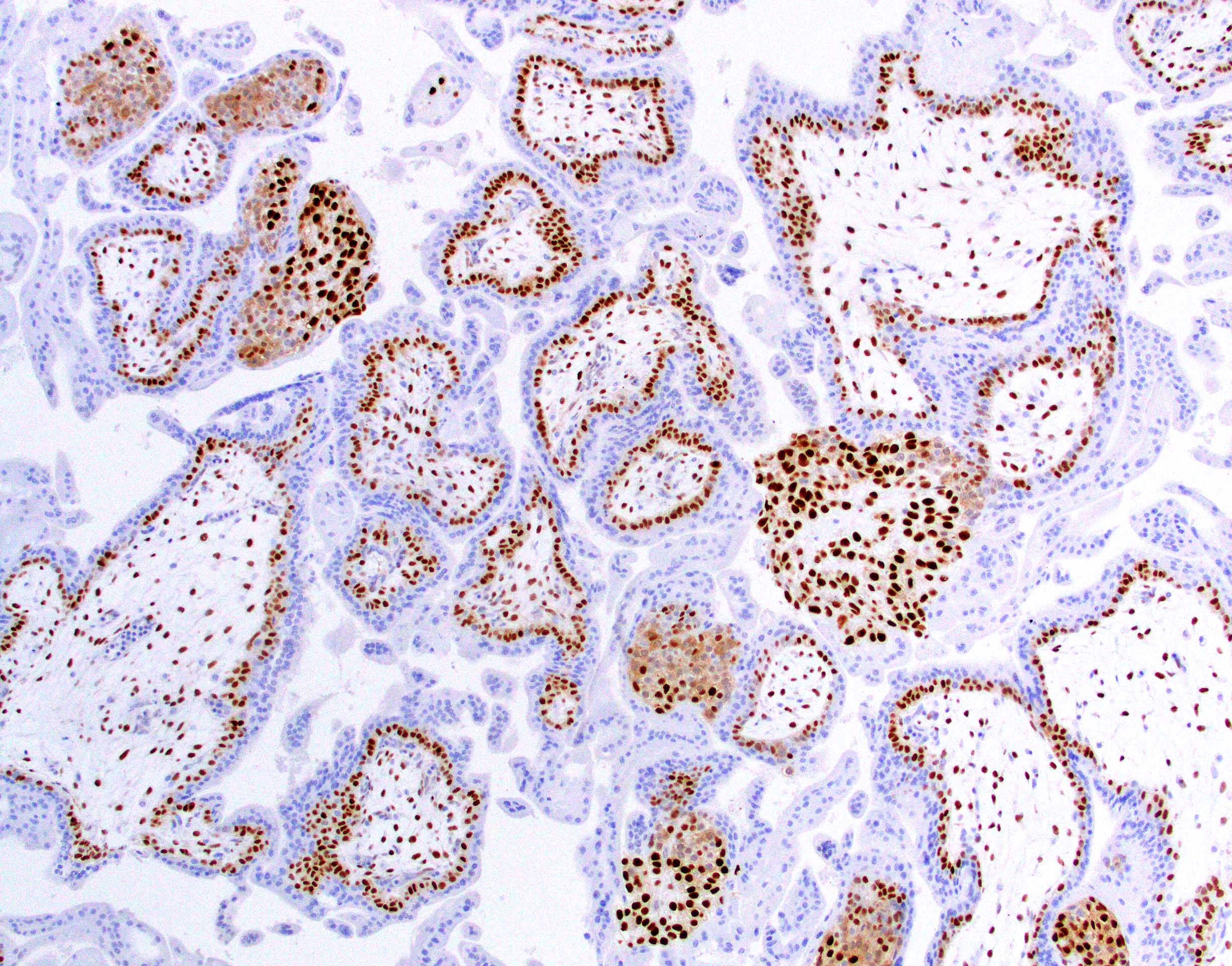 Normal p57 staining pattern