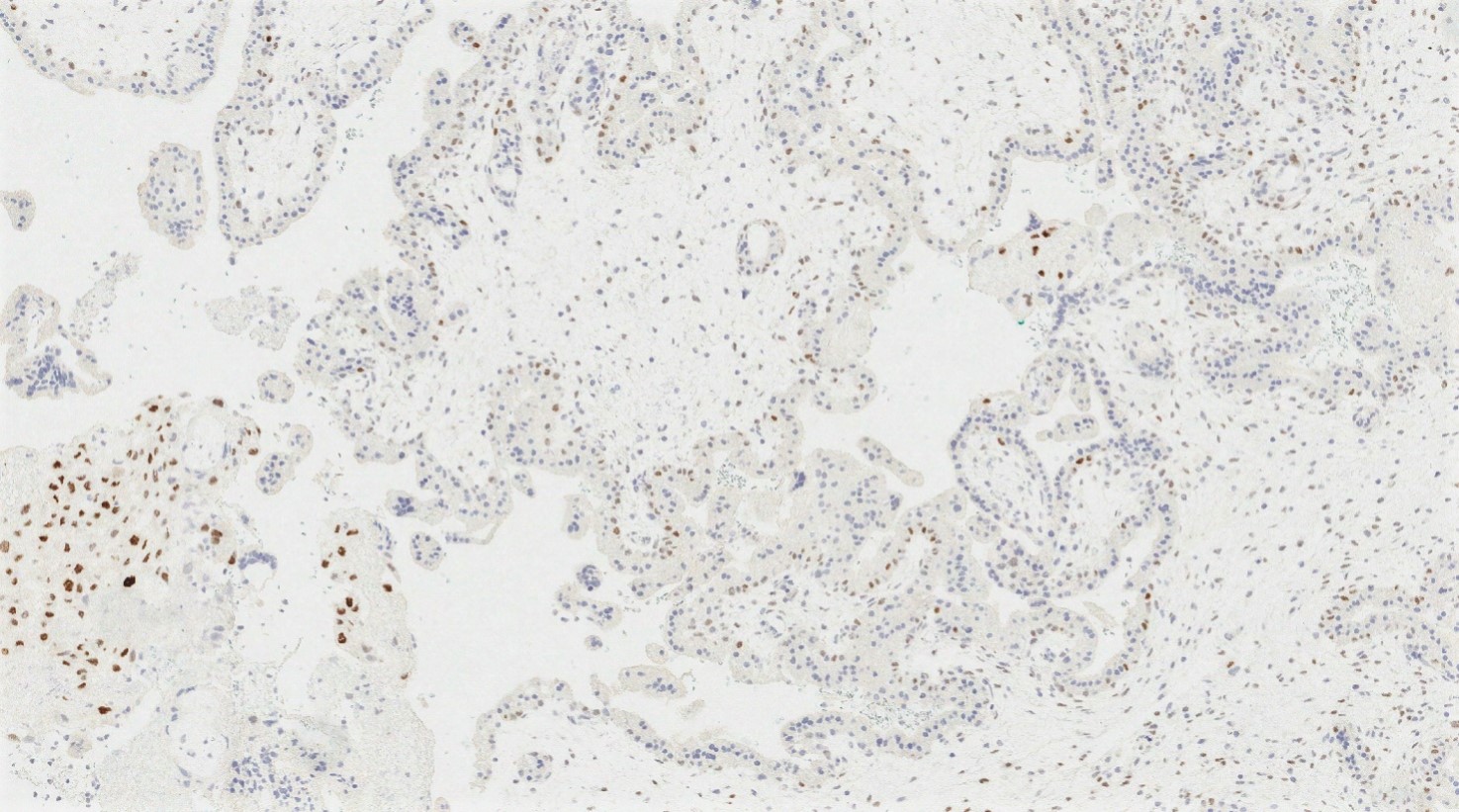 p57 nuclear staining