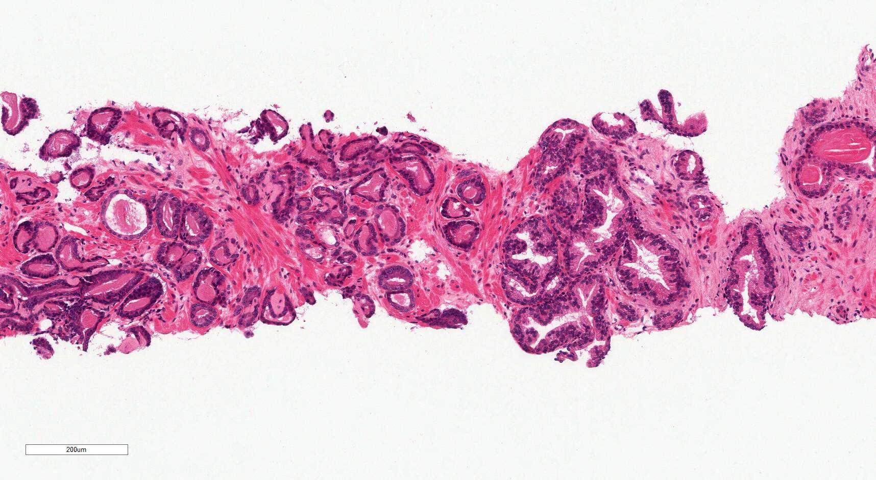 Pink amorphous material within gland lumens