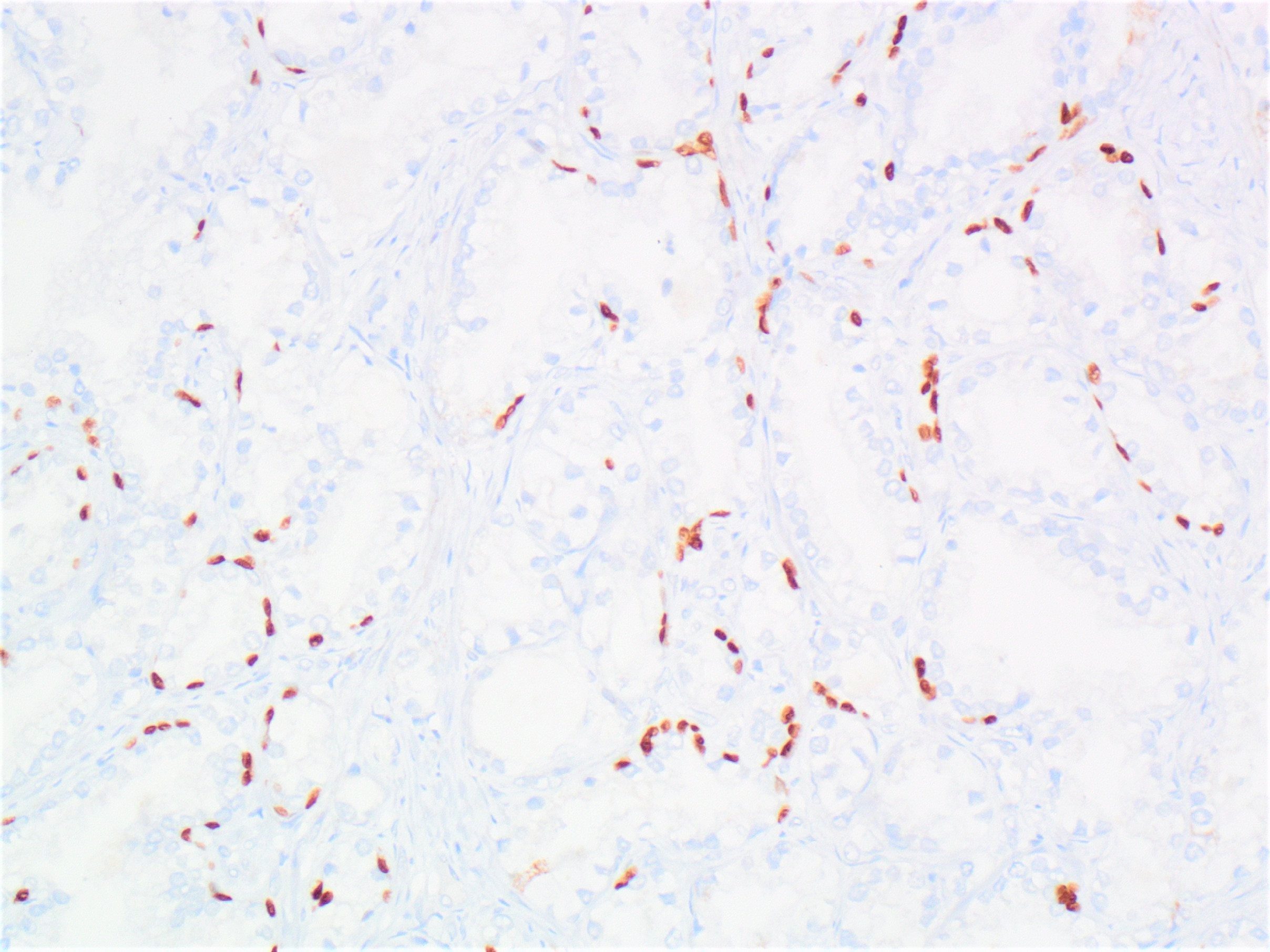 Fragmented basal cells