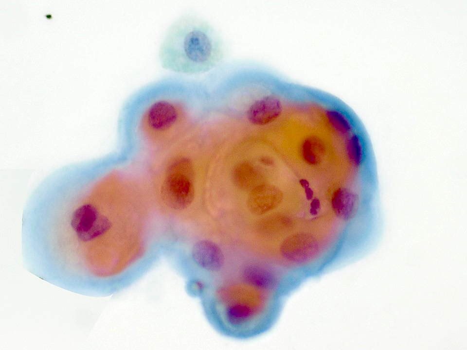 Keratinizing cells