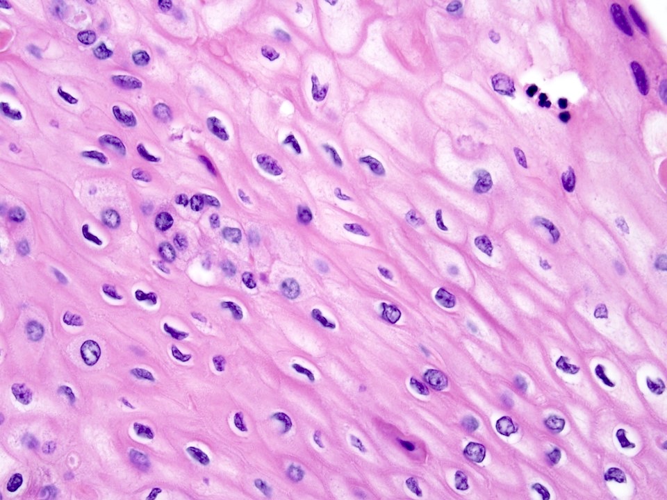 Epidermoid cells