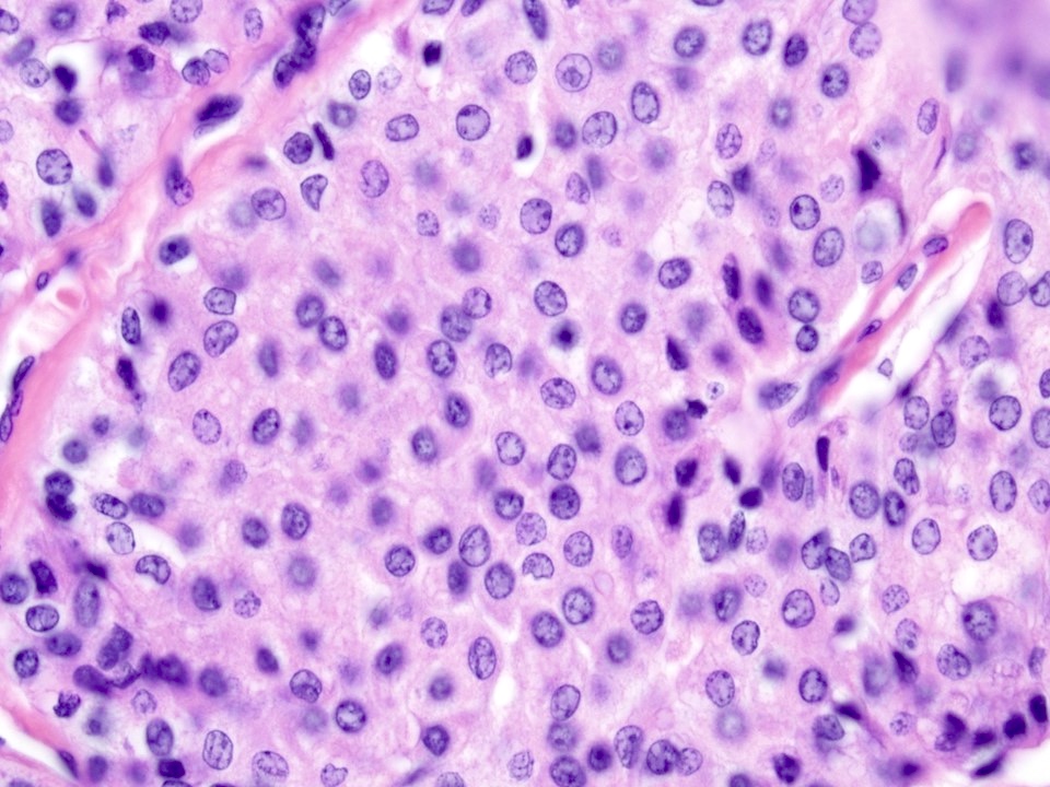 Intermediate cells