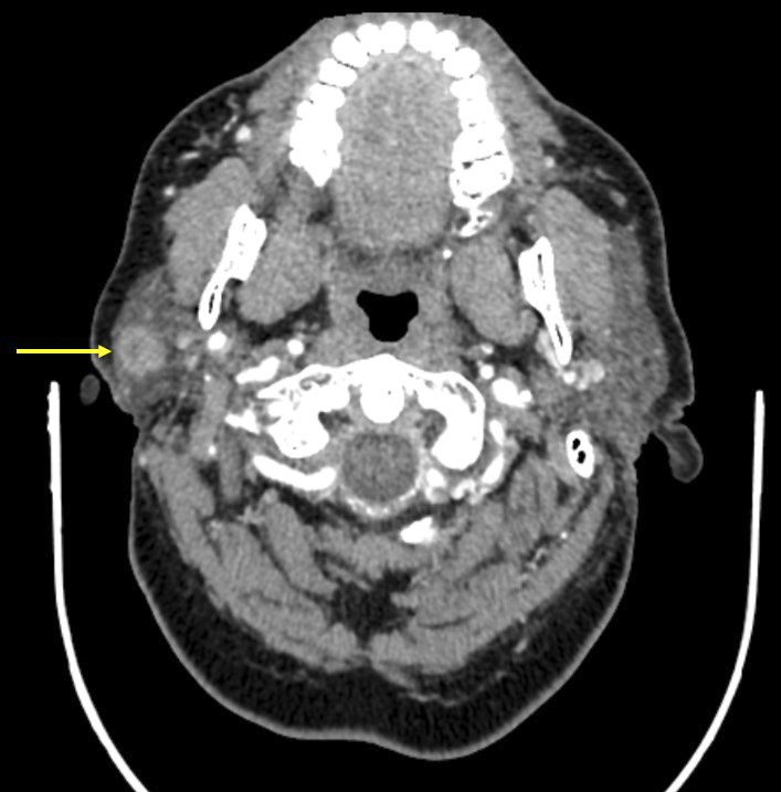 CT cross sectional view