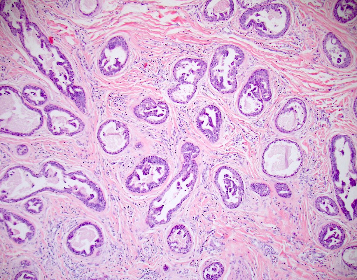 Tubules with micropapillae