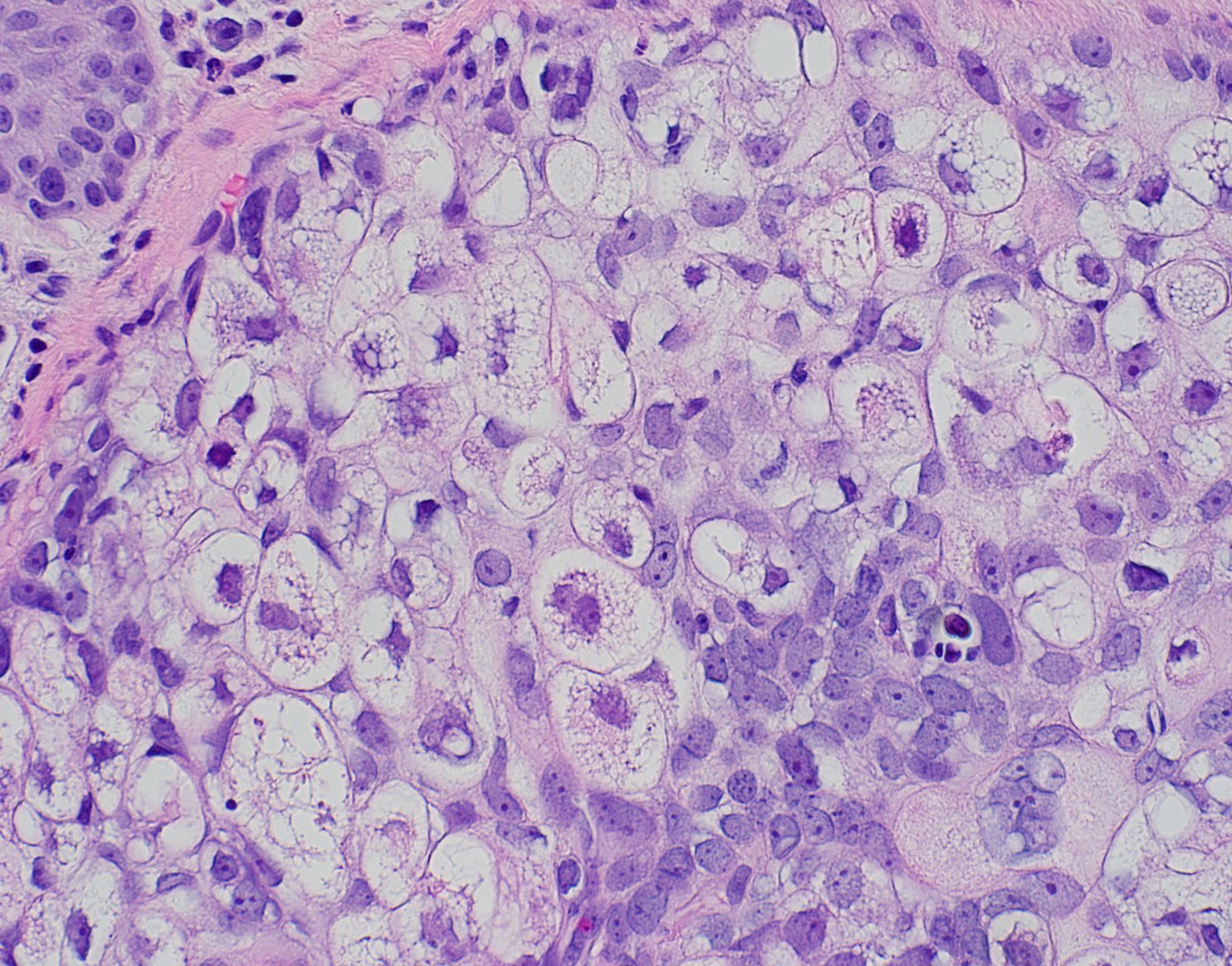 Multivacuolated cells