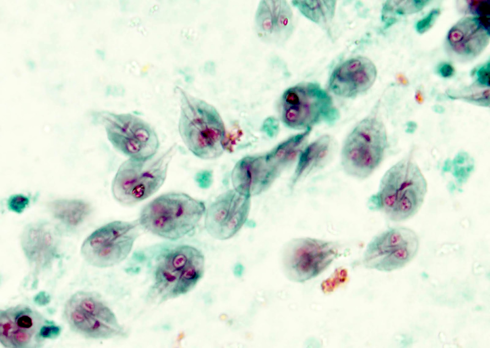 Giardia duodenum histology, Giardia histology