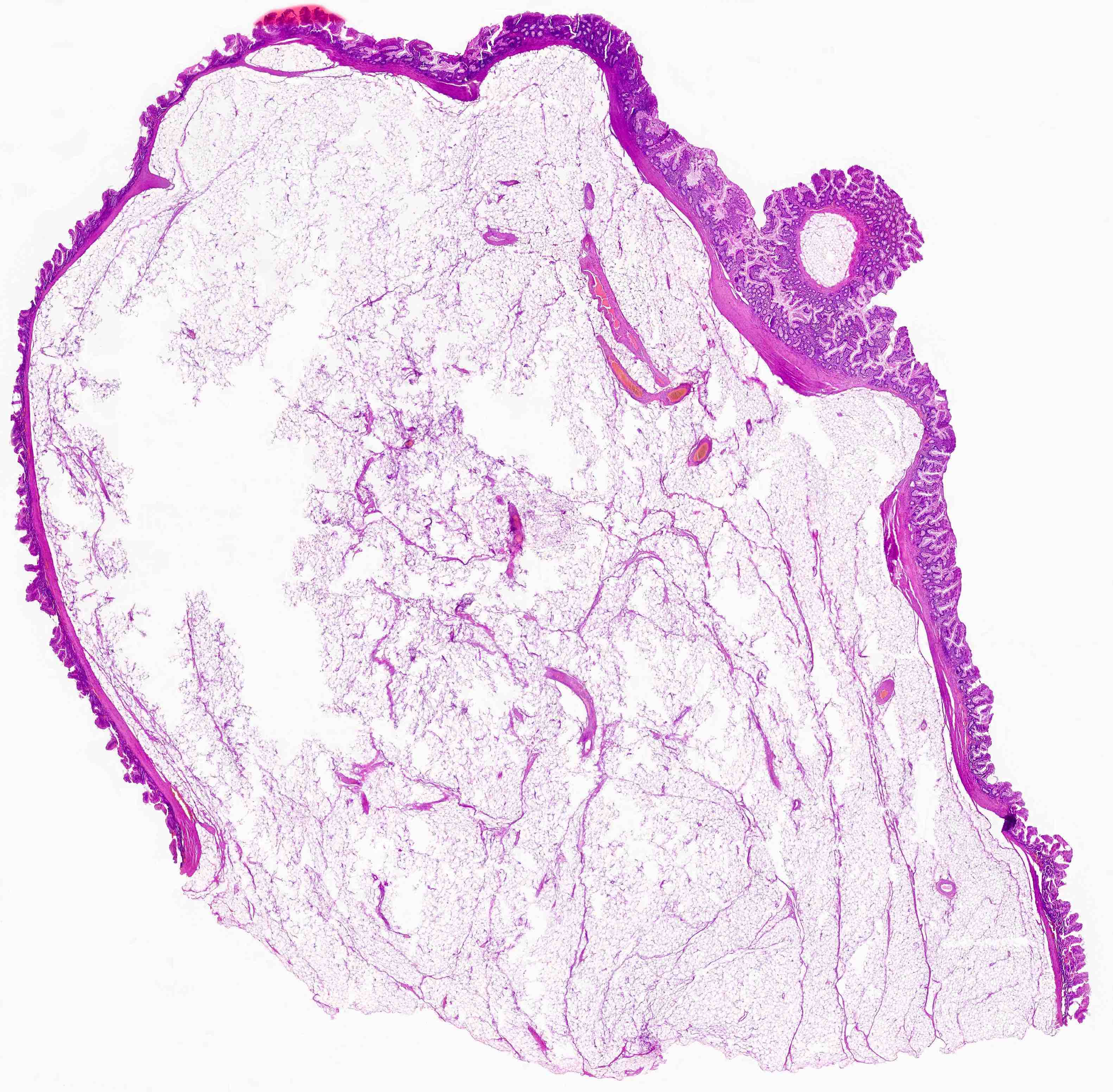 What Is The Pathology Of Anorexia