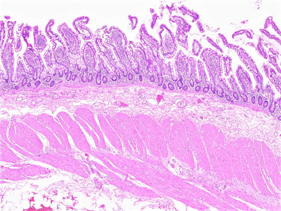 Layers of small intestine