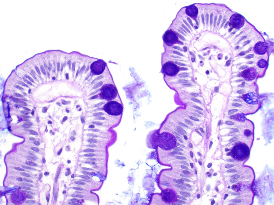 Microvilli and goblet cells