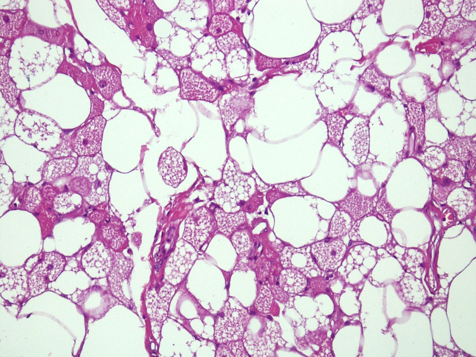Mixture of brown and white fat cells