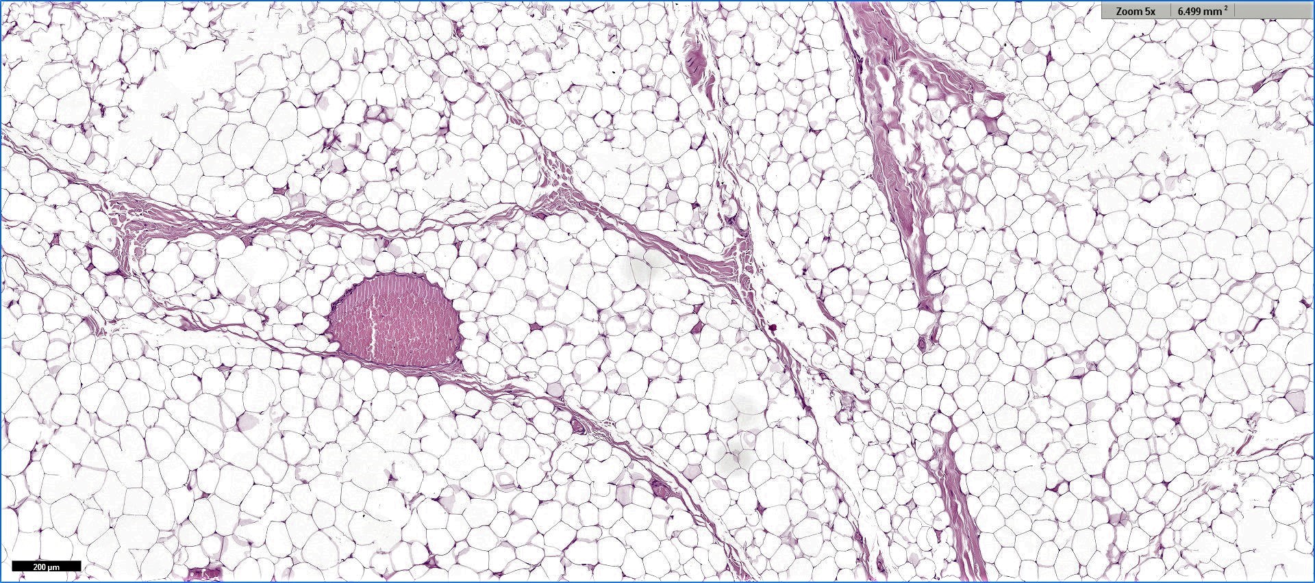 Paucicellular fibrous septa