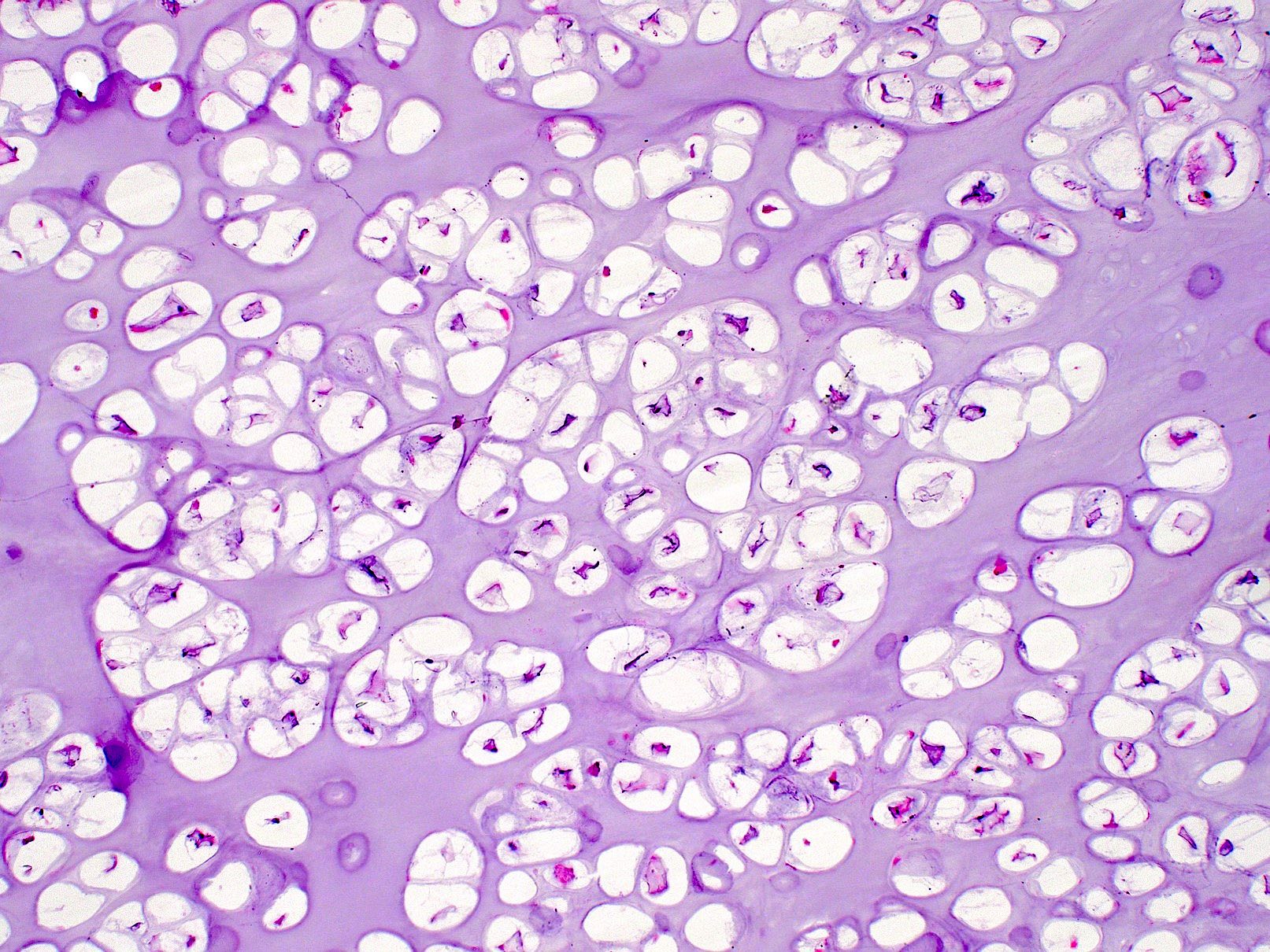 Chondrocytes with small nuclei