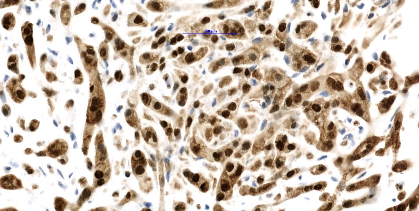 Nuclear CAMTA1 staining