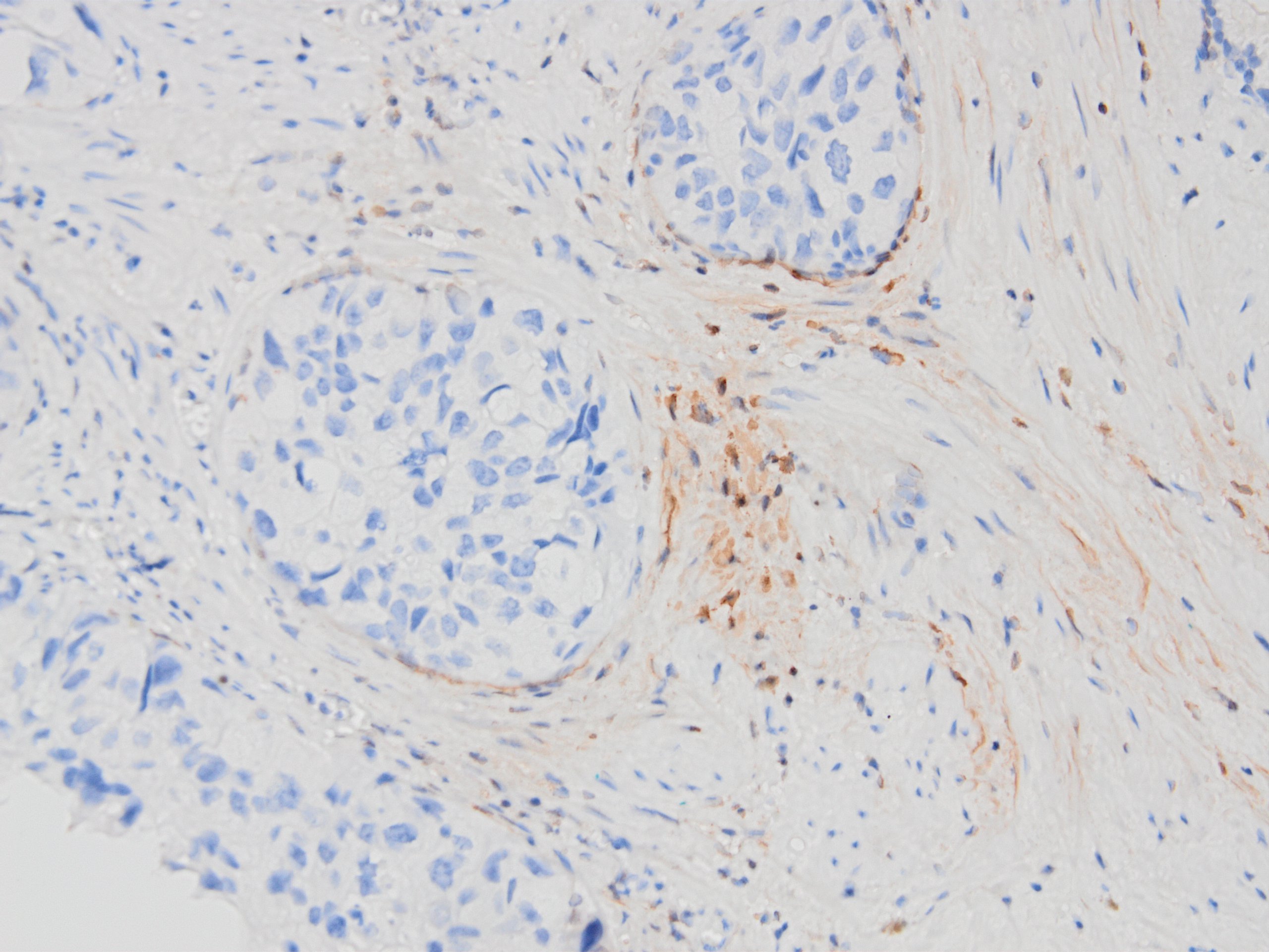 D2-40 in prostate basal cells
