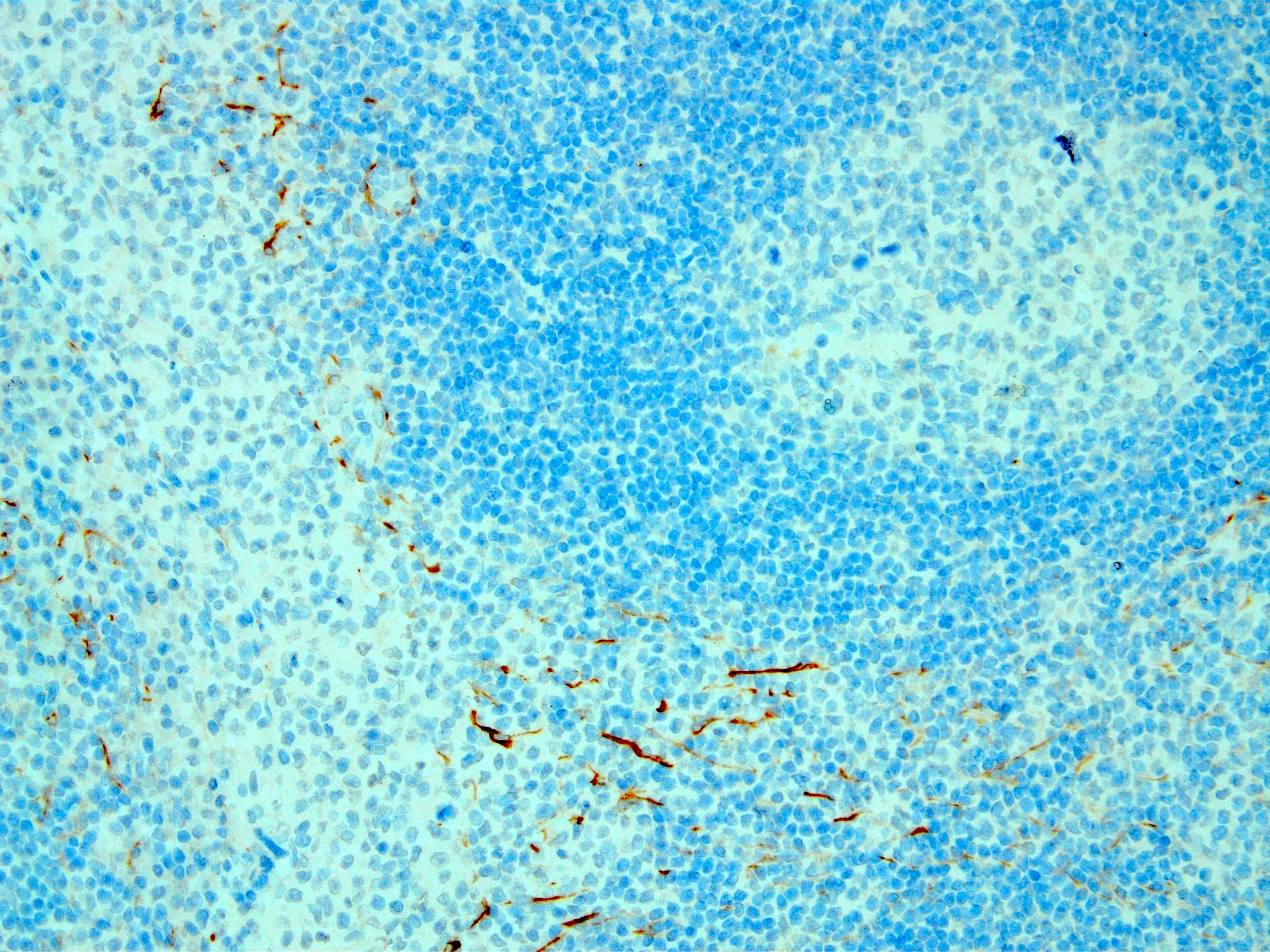 Dendritic cell staining in lymph node