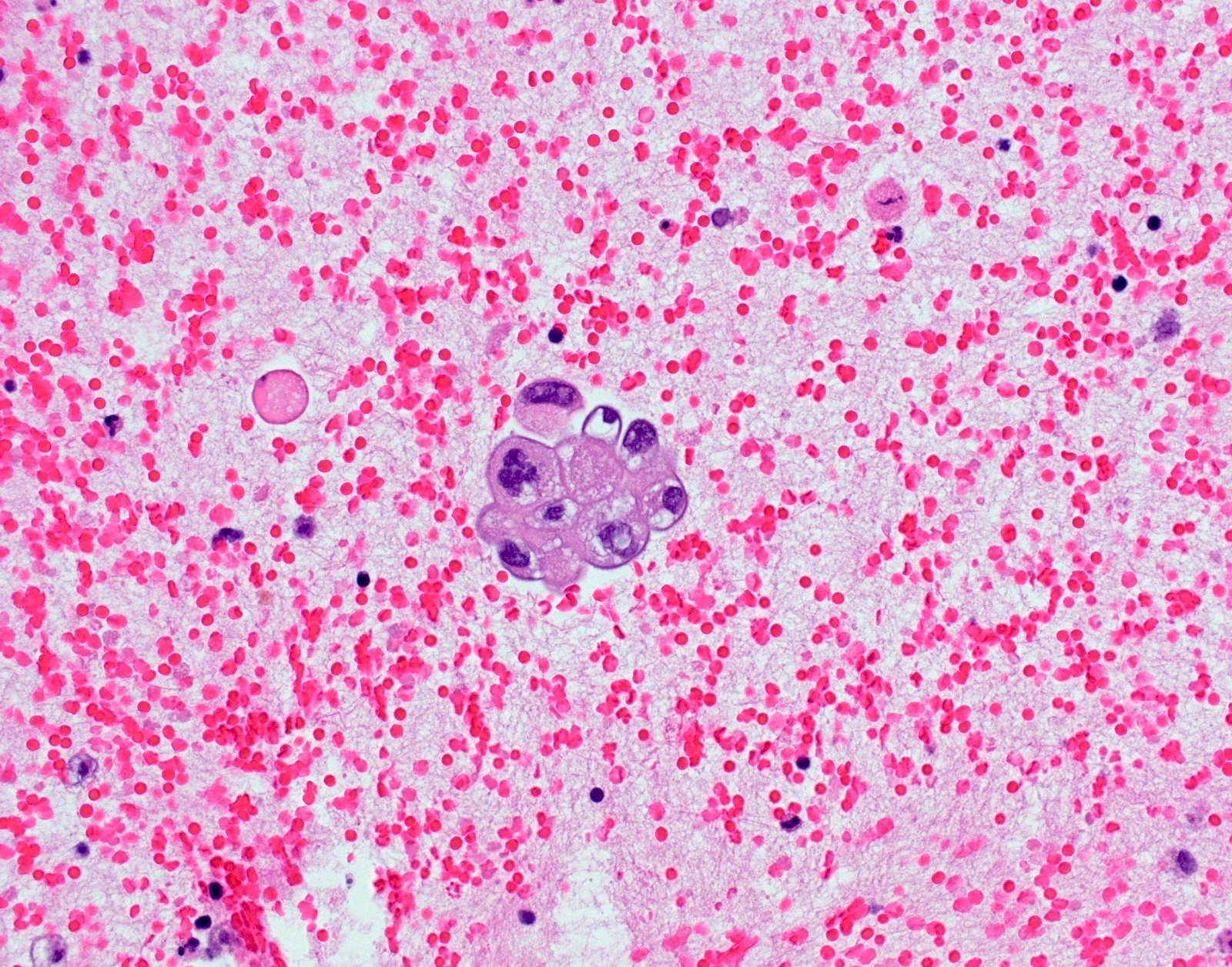 Positive result, scant cytology