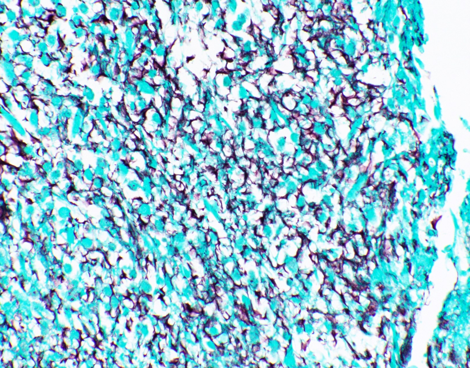 Thick extracellular mucin