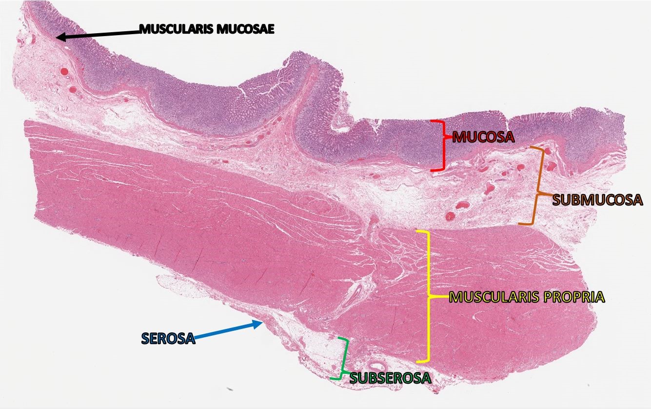 Stomach Wall Histology