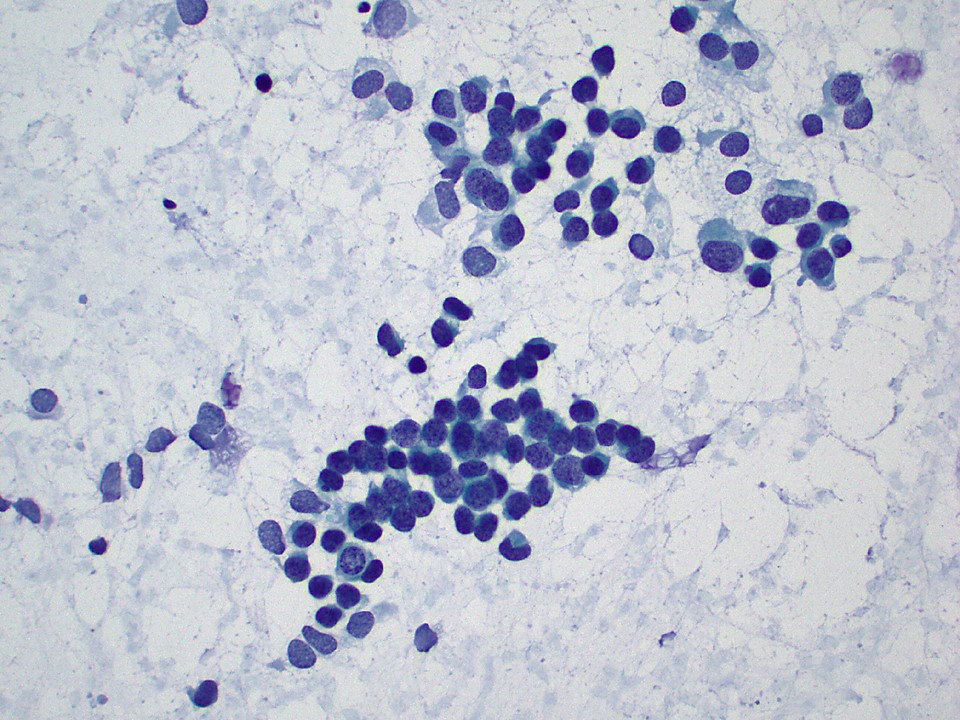 Tubular formations, monotonous small cells (Pap)