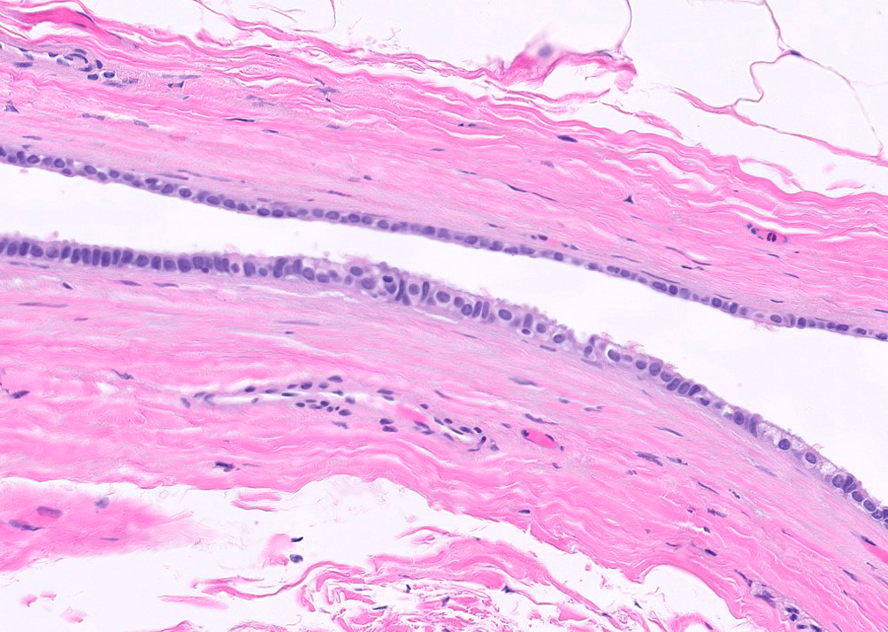 Ciliated columnar epithelium
