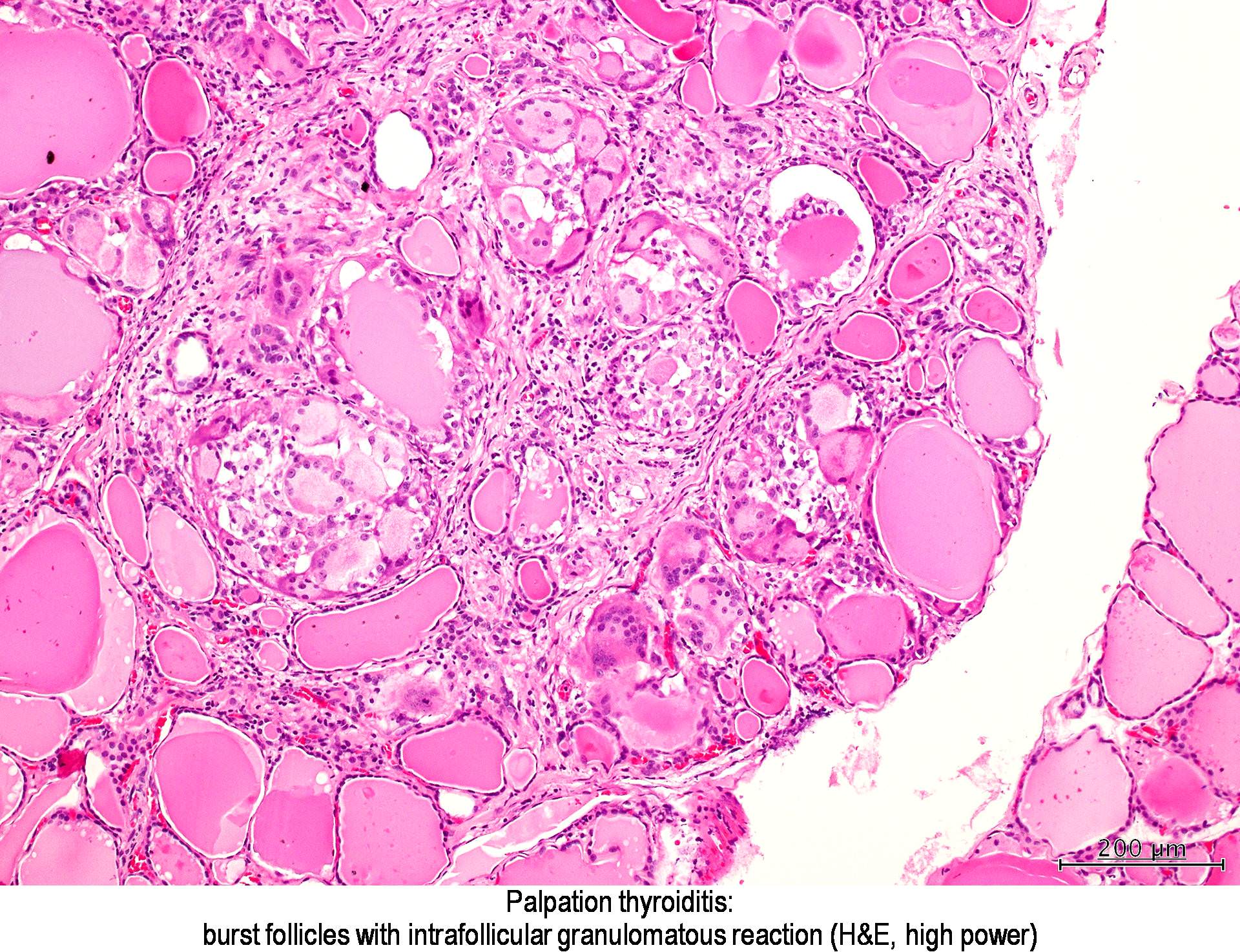 Giardia pathology outlines, new arrivals