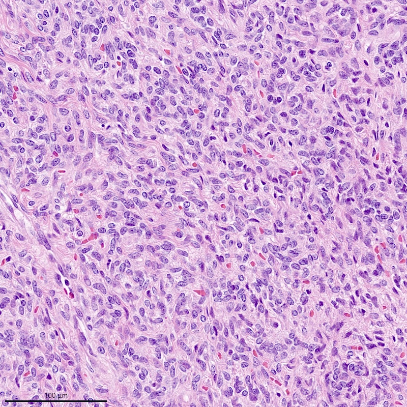 Monotonous tumor cells