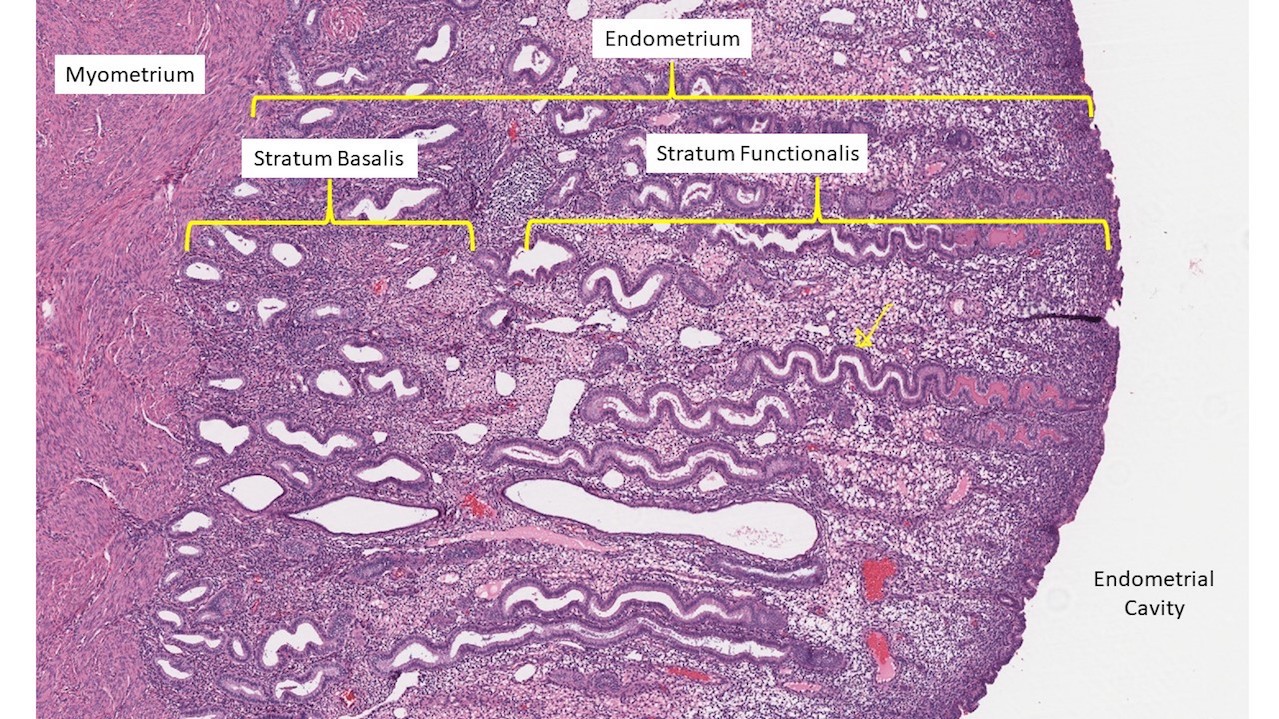 Pathology secretory endometrium Histological patterns