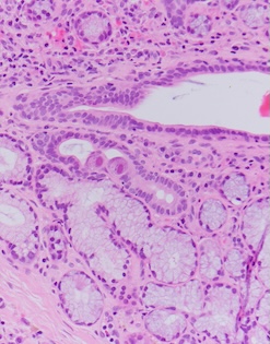 Mystery Image