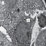 Adrenal chromaffin cells