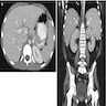 Longitudinal ultrasound, infant