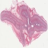 Adrenal gland, human