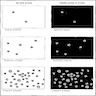 CERAD neuritic plaque assessment