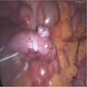 Intraoperative image