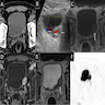 Axial nonenhanced CT, Doppler ultrasound, MRI, PET