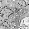 Osteoclast structure