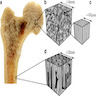 Cancellous and compact bone